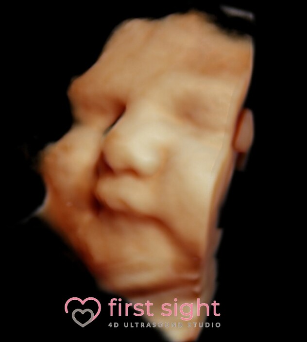 First Sight 4d Ultrasound Studio Pic 1