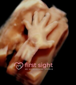 First Sight 4d Ultrasound Studio Pic 3