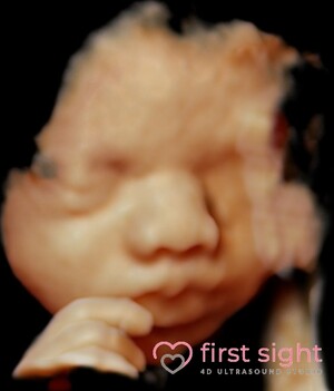 First Sight 4d Ultrasound Studio Pic 4