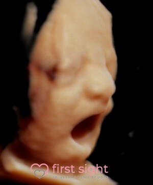 First Sight 4d Ultrasound Studio Pic 5