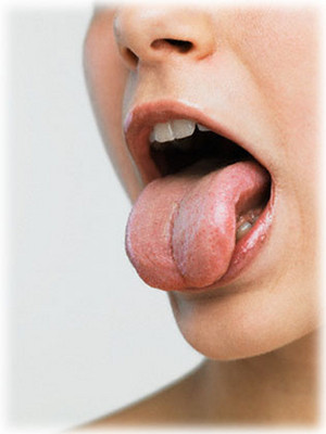 Sustain Health Pic 3 - tongue diagnosis