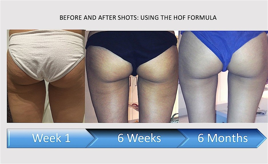 Holmes Online Formula Pic 1 - Before and After Shot using Holmes Online Formula