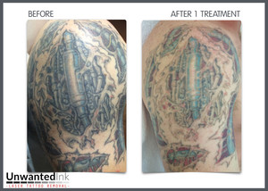 Unwanted Ink Laser Tattoo Removal Pic 4 - One sesh into this bio mech and the top layer of black ink that was covering all that colour is almost gone Watch this space this ones going to disappear fast