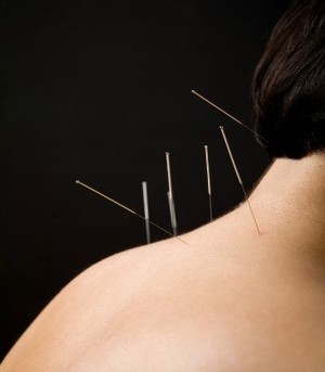 Tong Han Chun Herbs Acupuncture Sport Injury Centre Pic 2 - Acupuncture