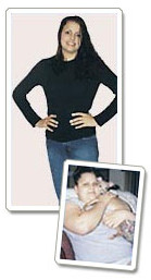 Amazing Weightloss Pic 1 - Stephanie D Before 103 kilos After 57 kilos Weight loss treatment Melbourne VIC