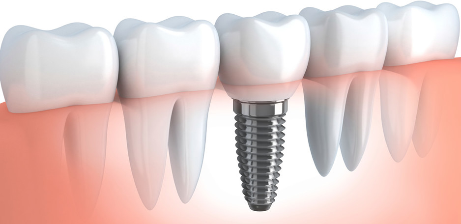 NQ Surgical Dentistry Pic 1