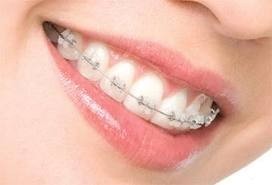 Monash Dental Group Pic 1 - Orthodontic Braces Treatment by Orthodontist specialist