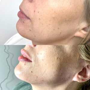 The Tox Fox Pic 5 - Cosmetic injectables Gisborne