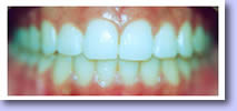 Edgecliff Orthodontics Pic 5