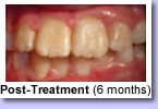 Edgecliff Orthodontics Pic 4