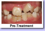 Edgecliff Orthodontics Pic 3