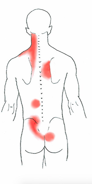 Trina Steer Military Rd Clinical Massage Pic 3 - Common pain sites