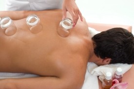 Moreland Osteopathy Pic 2 - We also offer Cupping therapy