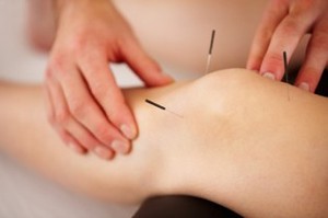 Moreland Osteopathy Pic 4 - We also offer Dry Needling