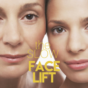 Face Today Mediclinic Pic 4 - our signature SLOW FACELIFT includes expert Platelet Rich Plasma treatments AKA Vampire Face Lift which give a naturallooking refreshed and rejuvenated appearance