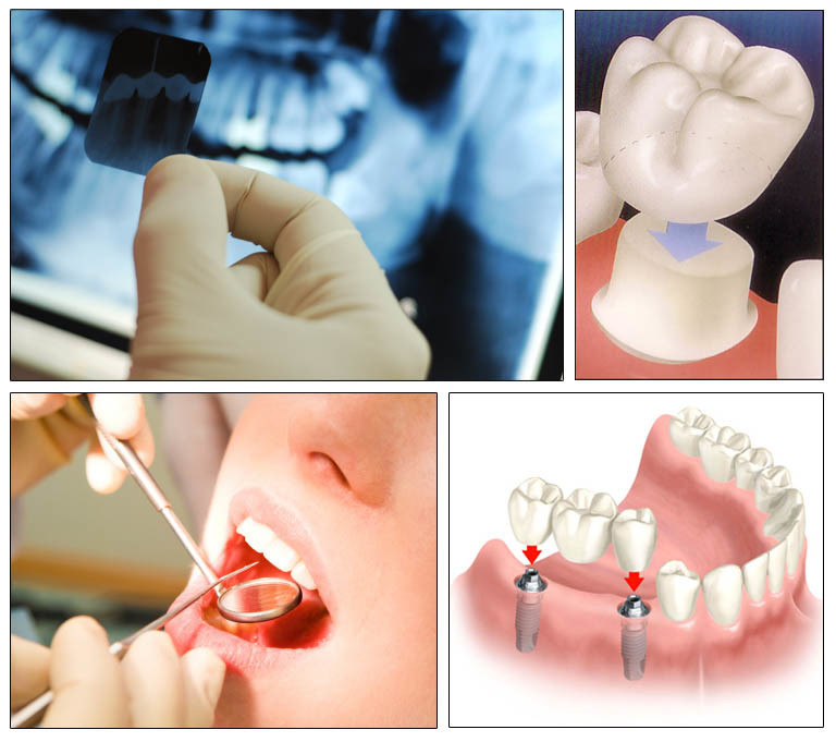 Bupa Dental Pic 1