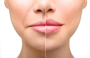 Rejuskin Clinic- Cosmetic injection Pic 3