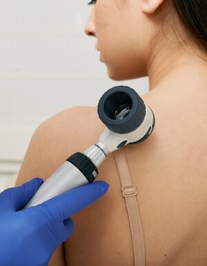 ISO Skin Cancer and Laser Clinic Pic 3