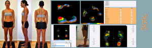 YourPodiatristBrisbane.com Pic 2 - 2 Gait and Posture Assessment