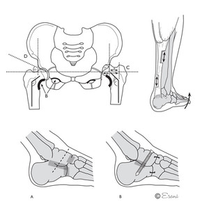 esani Pic 3 - Medical Illustration