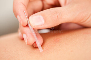 Qi for Life Acupuncture Pic 4