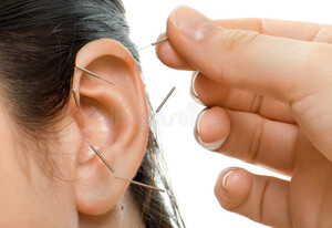 Qi for Life Acupuncture Pic 5