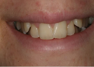 McCloy Dental Pic 2 - Before McColy Dental Treatments