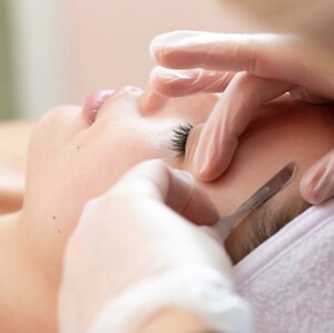 Alexia Rocha Aesthetics Pic 5 - Dermaplaning