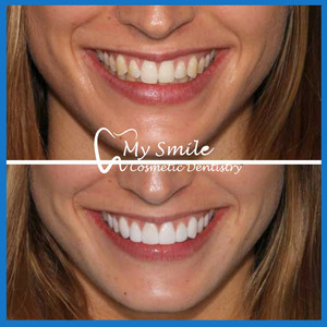 My Smile Cosmetic Dentistry Pic 5