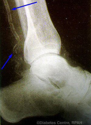 NQ Foot & Ankle Centre Pic 4