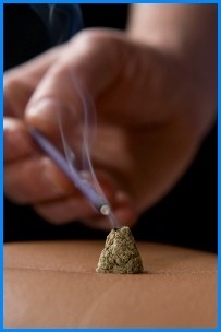 Momiji Acupuncture and Traditional Medicine Pic 4 - Japanese Moxibustion