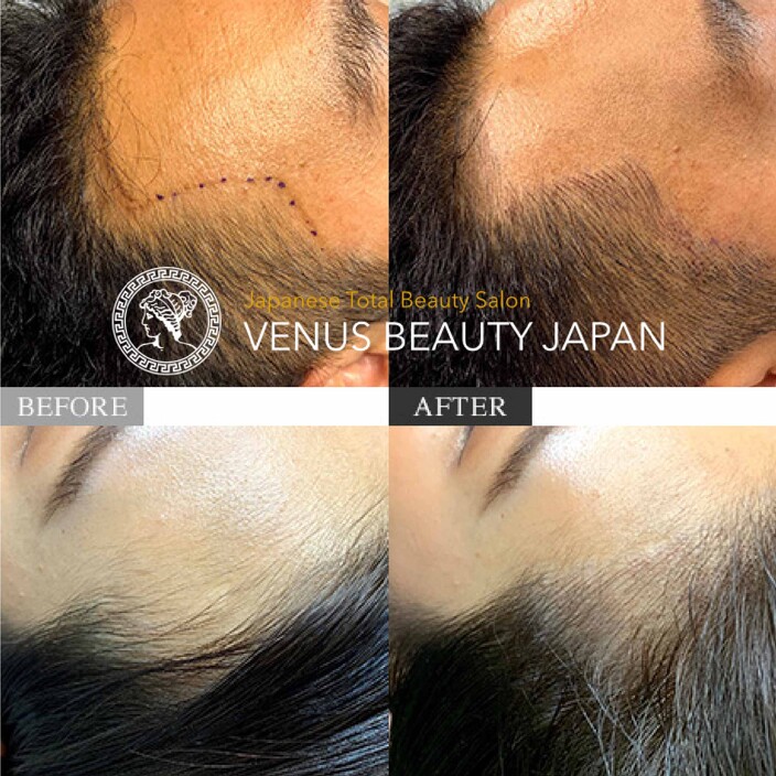 Venus Beauty Japen Pic 1