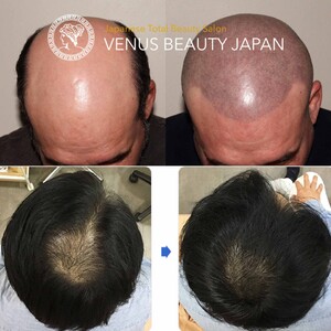 Venus Beauty Japen Pic 2