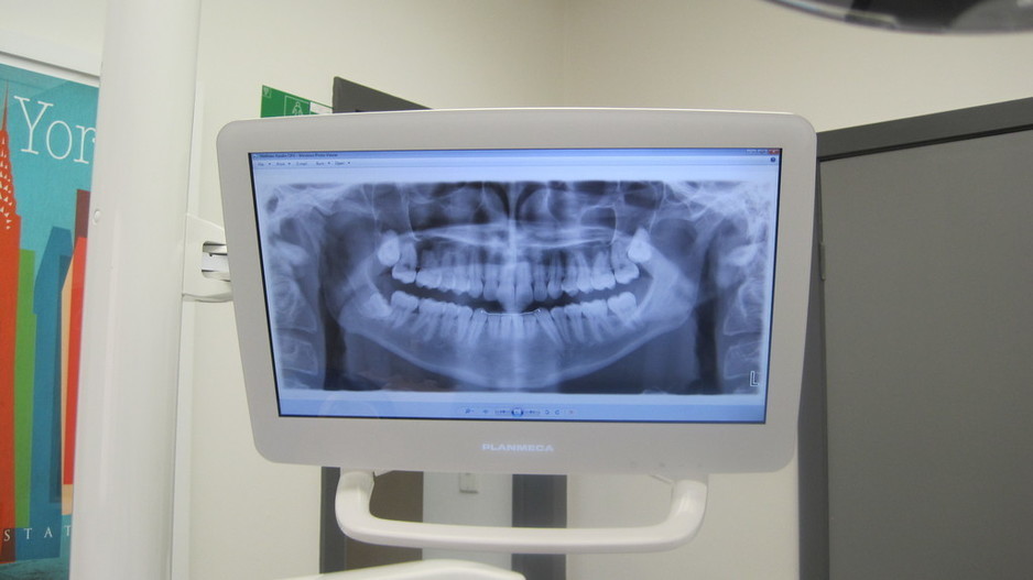 Carlton Dental Care Pic 2 - In house digital radiology