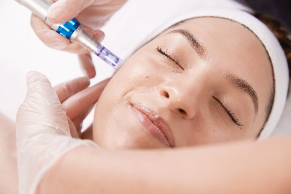 Natural Glow Skin And Beauty Pic 1 - Microneedling