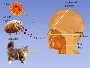 Airway Allergy Clinic Pic 4 - Hayfever diagram