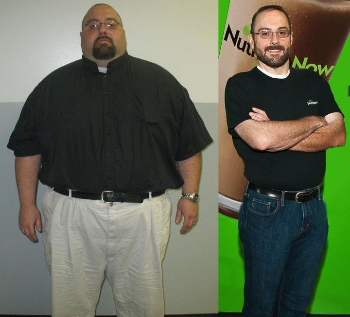 The Weight Management Specialists Pic 2 - Quality of life improved dramatically