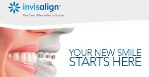 Smile Central Pic 5 - Invisalign dentist