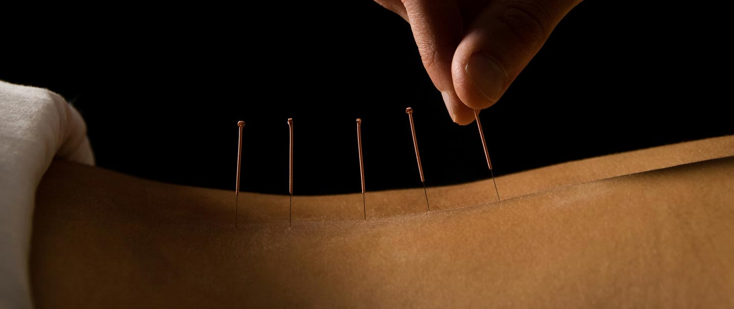 Bloom in Neutral Bay, Sydney, NSW, Acupuncture TrueLocal